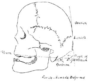 OBELYON