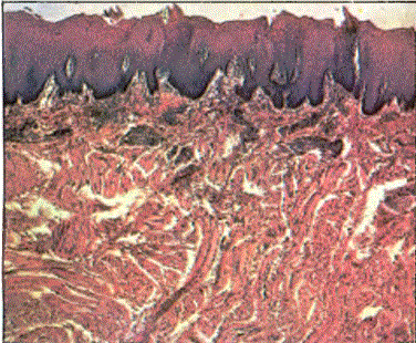 En üstte lifler biçiminde keratin, altında epidermi s, en altta ise dermiş tabakası görülmektedir
