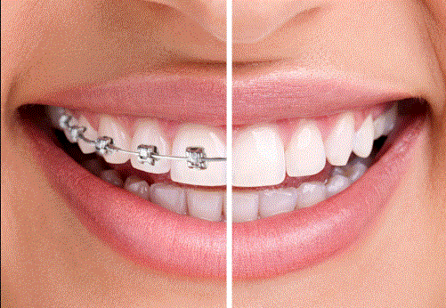 ortodonti