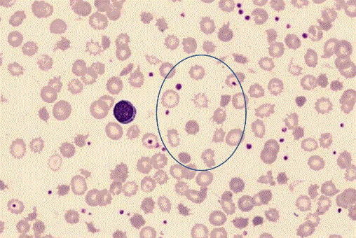 spur-cell-anemisi